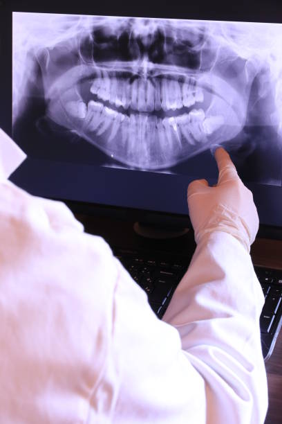 Best Emergency Dental Extractions in Tavares, FL